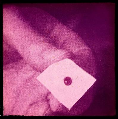 Santé publique: lutte contre la tuberculose, acte médical, vaccination.