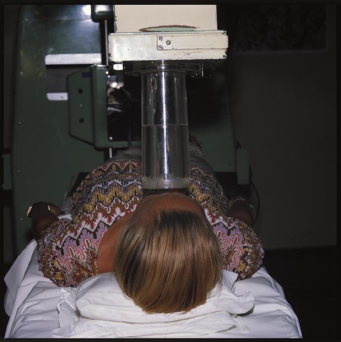 Appareil de radiologie: bombe Cobalt avec patient.
