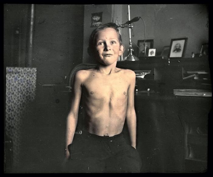 Santé publique: lutte contre la tuberculose, acte médical, consultation médicale.