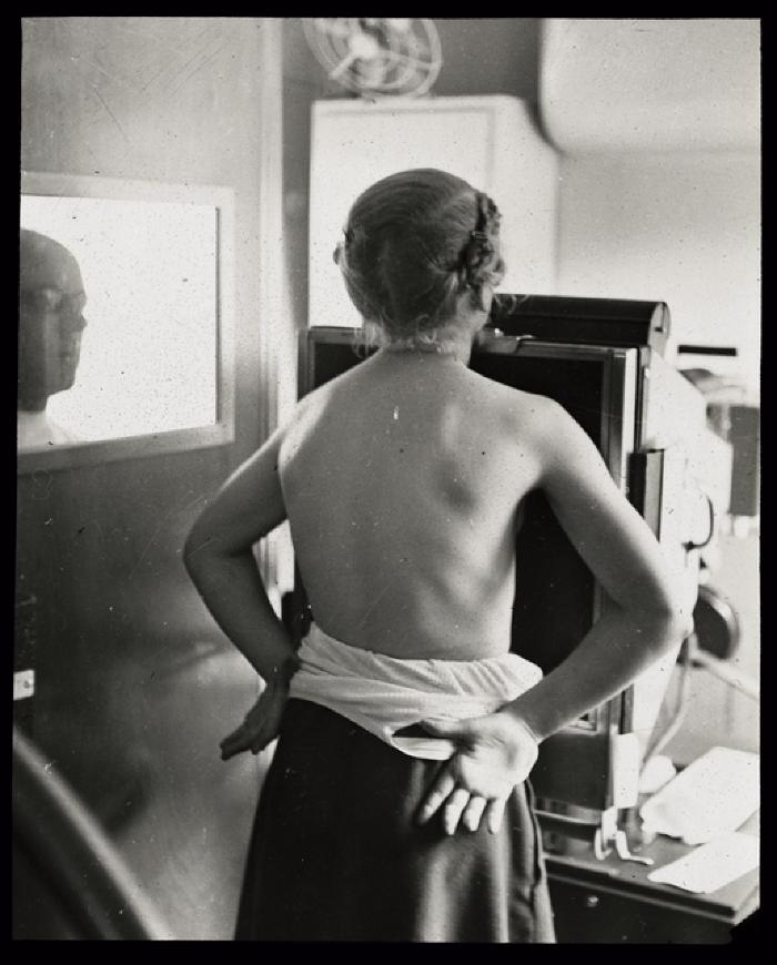 Santé publique: lutte contre la tuberculose, acte médical, consultation médicale, radiographie.