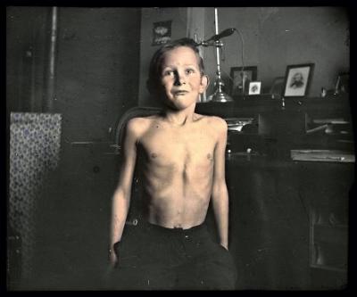 Santé publique: lutte contre la tuberculose, acte médical, consultation médicale.