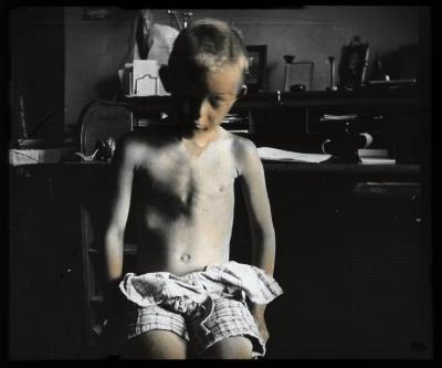 Santé publique: lutte contre la tuberculose, acte médical, consultation médicale.