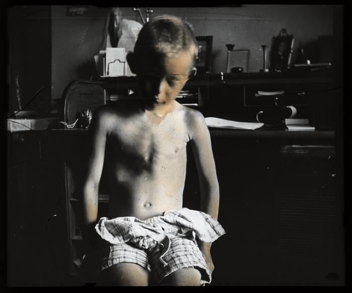 Santé publique: lutte contre la tuberculose, acte médical, consultation médicale.