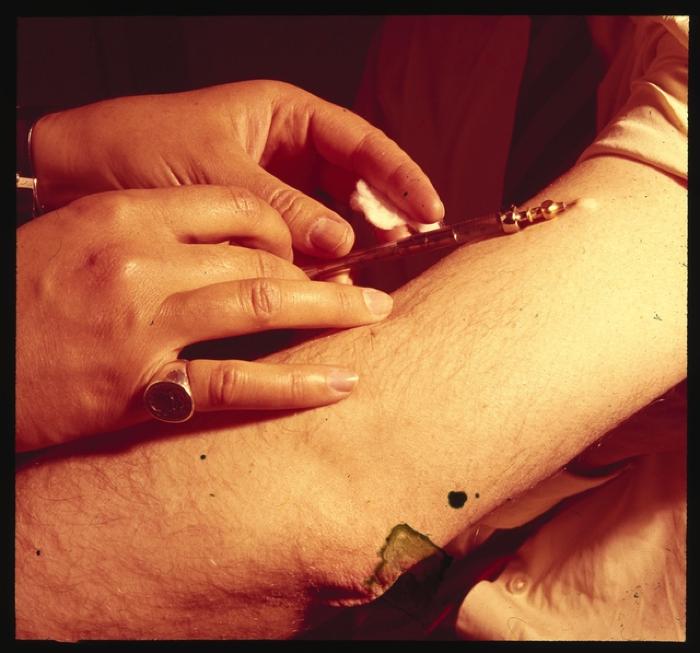 Santé publique: lutte contre la tuberculose, acte médical, vaccination.