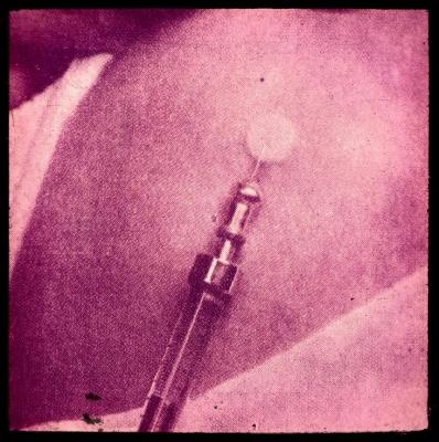 Santé publique: lutte contre la tuberculose, acte médical, vaccination.