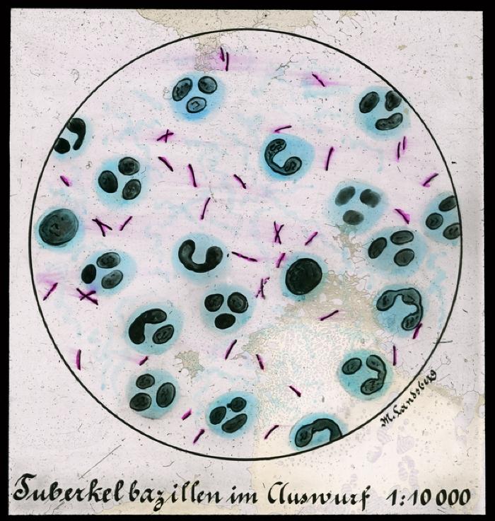 Document médical, image du bacille de Koch.