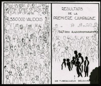 Document pédagogique dédié à l'information du public, statistiques (résultats campagne de radiographies).