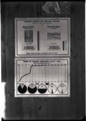 Document pédagogique dédié à l'information du public, statistiques (influence de l'assainissement et de l'âge).