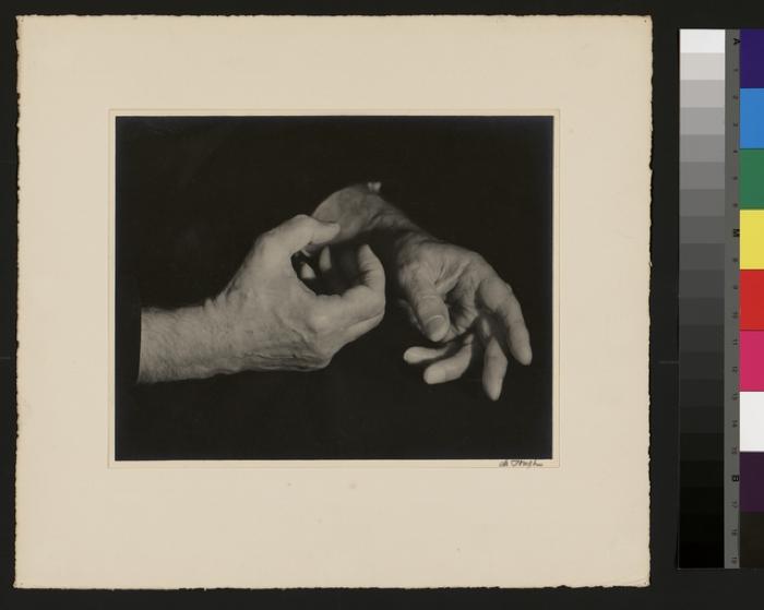 Les mains du professeur César Roux.