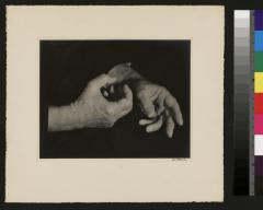 Les mains du professeur César Roux.